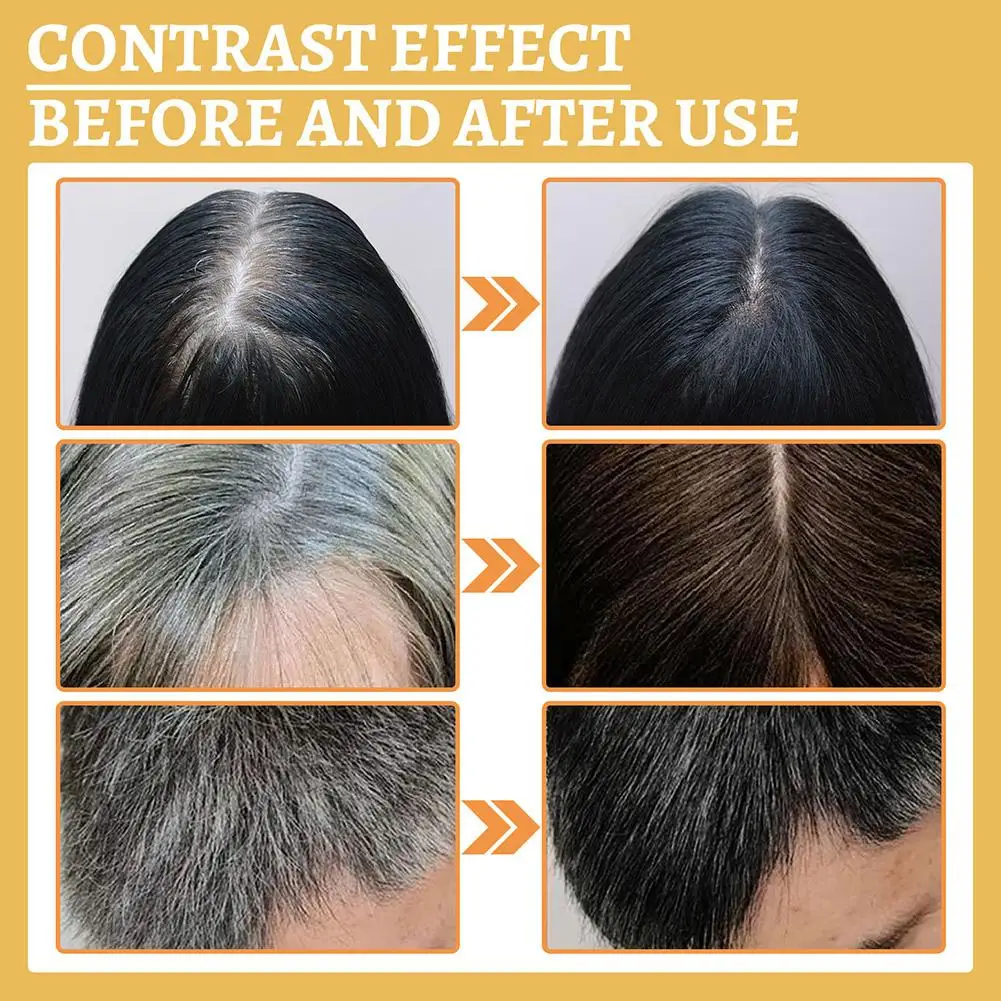 3Pcs Grey Hair Reverse Serums  - Licorice Root Sticks recension och pris