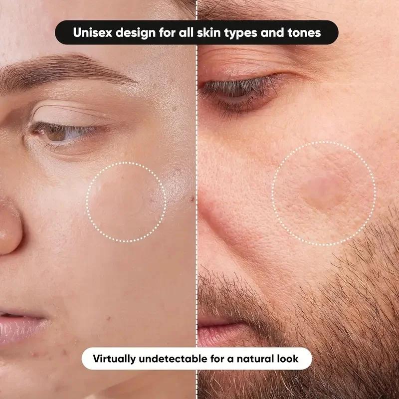 360 pieces/box acne patches -  - Essential Oils recension och pris